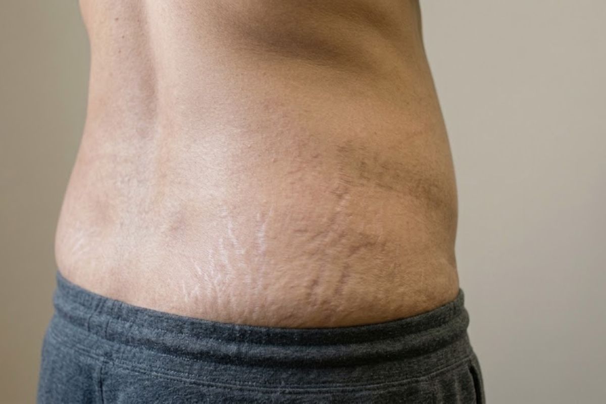 After treatment